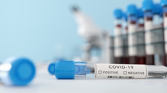 Detailansicht eines PCR-Teströhrchens mit der Aufschrift Covid-19, positive, negative und Strichcode, im Hintergrund verschwommen weitere Teströhrchen