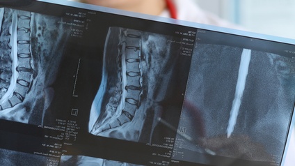 Röntgen: Röntgenassistenz Ausbildung