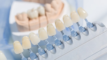 Detailansicht nebeneinander aufgesteckter Zahnersatze, im Hintergrund verschwommen Modell eines Gebisses
